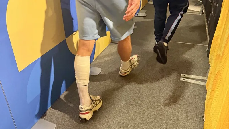Declan Rice limps with strapped calf after England draw Declan Rice walking with a noticeable limp and a strapped left calf after England's World Cup match against Ghana. — latest news and analysis.