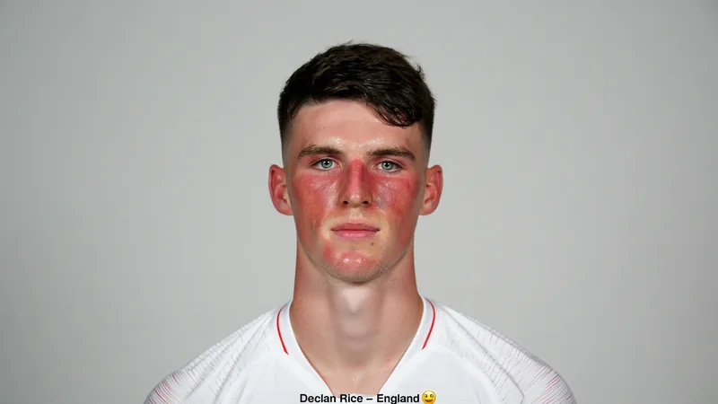 Offizielles FIFA-WM-Porträt von Declan Rice mit deutlich sichtbarem Sonnenbrand im Gesicht, aufgenommen in Katar. — latest news and analysis.